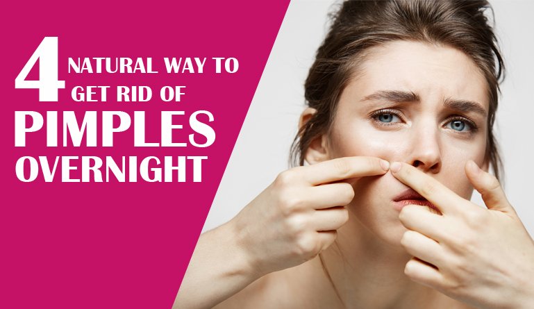 How can we remove pimples naturally?